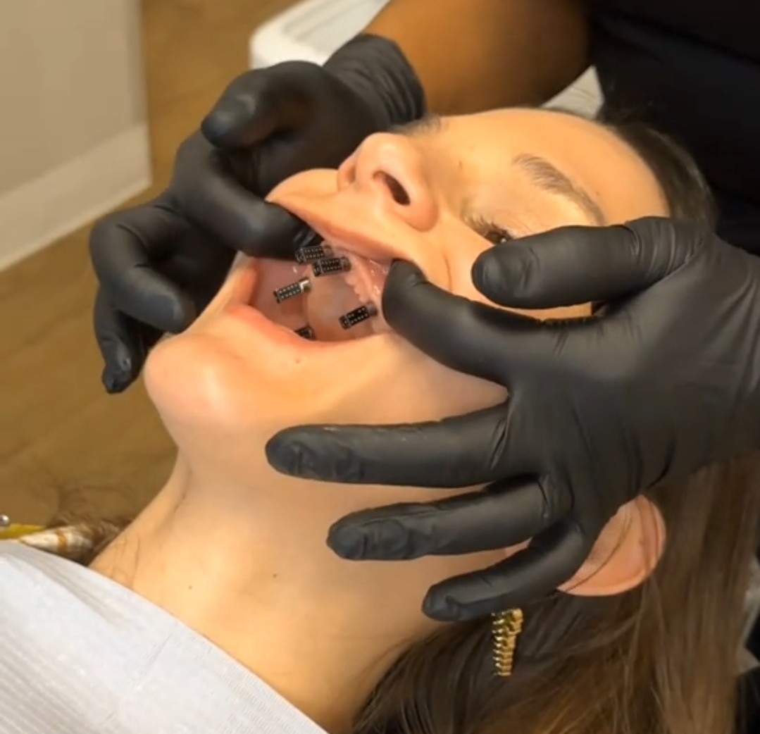 Understanding Dental Implants: A Comprehensive Guide